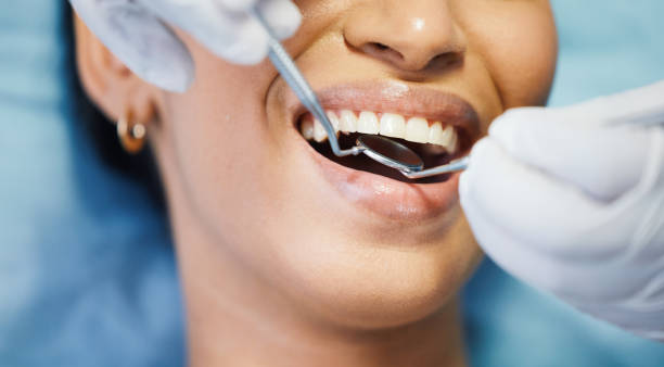 Best Dentist for Dental Trauma  in Bridgeport, NE