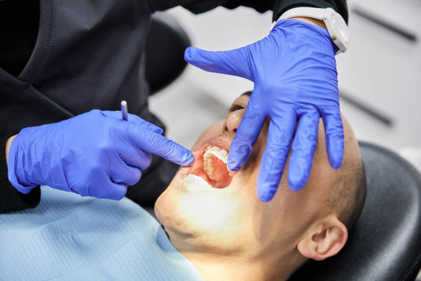 Best Emergency Gum Pain Relief  in Bridgeport, NE
